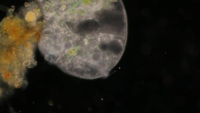 Protozoa and Stentor in waste water under the microscope.