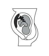 Placental previa. Fetus in Uterus During Pregnancy. Pregnancy women anatomy. Fetus with umbilical cord and placenta.
Usual anatomical Placenta Location. Detailed medical vector illustration.
