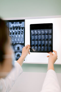 Crop dentist analyzing X ray image of teeth in hospital