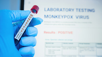 hand holding blood collection tubes and data sheet on monkeypox test positive results in...