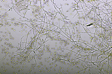Picture of fungus and red blood cells in hemoculture tube, analyze by microscope 400x