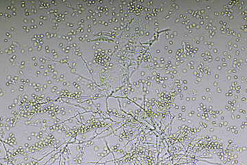Picture of fungus and red blood cells in hemoculture tube, analyze by microscope 400x