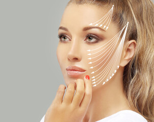 Thread Lift ,markup, thread-lift procedure for facial rejuvenation.