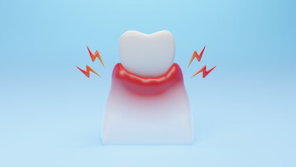 unhealthy Gum inflammation disease by gingivitis. Dental Gum and teeth treatment concept. 3D rendering.