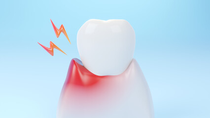 Gums gum inflammation, gingival recession. Dental treatment concept. 3D rendering. - obrazy, fototapety, plakaty