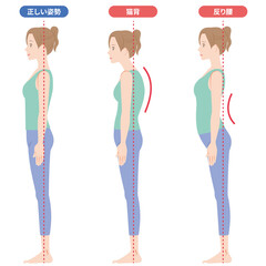 猫背と反り腰