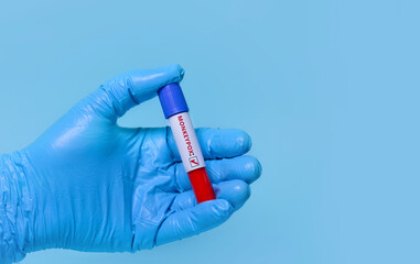 Doctor holding a test blood sample tube positive with Monkeypox virus (MPXV) .The virus is transmitted from animals to humans. Infected people suffer from fever, cough, headache, nausea and vomiting. 