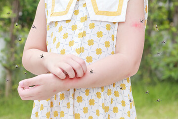 Little girl has skin rash allergy itching and scratching on her arm with mosquitoes bite