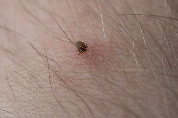 Teak with its chelicerae adhering to human skin.