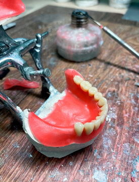 Artificial dentures in the manufacturing steps in the dental lab. Dental orthodontic mold with tools. Natural full prosthesis made of quality materials in plaster model. Selective focus, close up