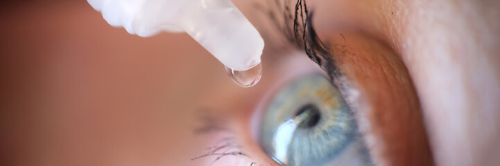 Drops from vial dripping into woman eye closeup