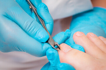 A chiropodist in blue medicine gloves gives a pedicure to the client's foot, cutting dry skin with clippers. Close up. The concept of salon foot care