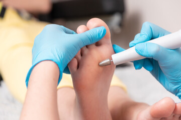 Chiropodist in blue medical goves does hardware peeling of the skin of the female smooth foot....