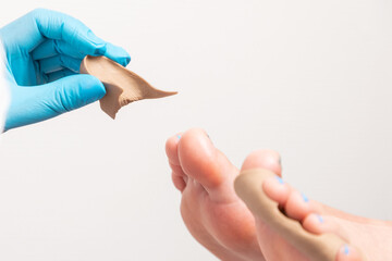 Procedure in podiatry clinic. Podiatrist in blue gloves inserts a silicone impression between...