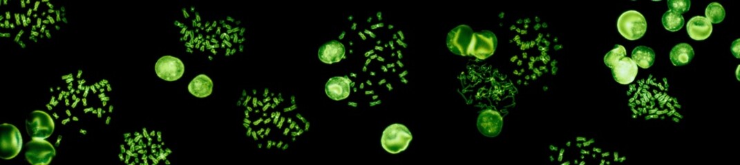Chromosomes under fluorescence microscope, green colored Human chromosomes from blood