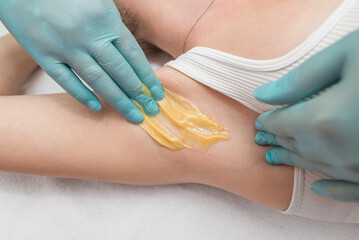 Depilation and epilation of the female armpit with liquid sugar paste. The beautician's hand applies wax paste to the armpit.