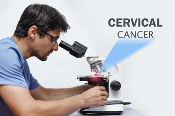 A doctor in a medical uniform a histologist looks into a microscope a biopsy of cervical cancer,...
