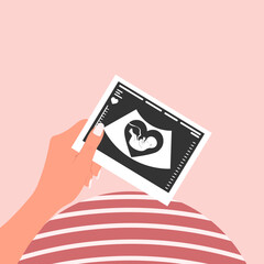 A happy pregnant woman holds a picture of a fetal ultrasound scan. An ultrasound picture of the baby. Vector