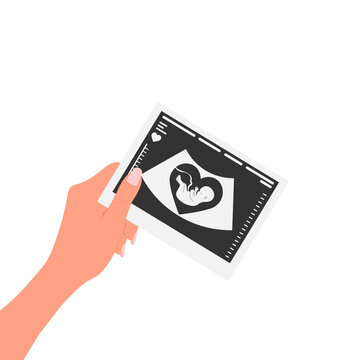 Happy pregnant girl holding a picture of her baby's ultrasound in her hand against a white background. Vector