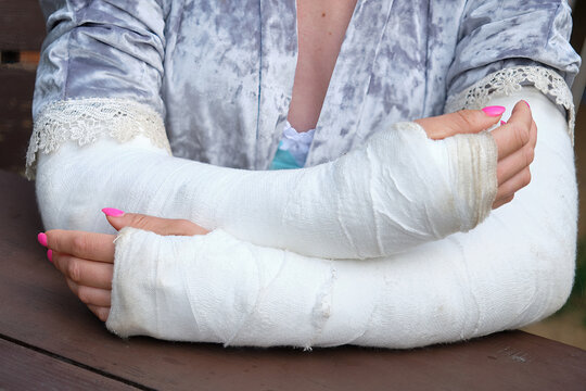 Close-up of a woman's broken arms in a cast
