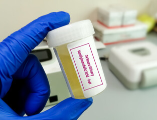 Urine sample for VMA (Vanillylmandelic acid) Test,  used to detect neuroblastomas and neuroendocrine tumors.