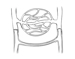 vector of arteriovenous anastomoses. -Arterio-venous anastomoses (AVAs) are direct connections between small arteries and small veins. In humans, they are numerous in the glabrous skin of the hand.