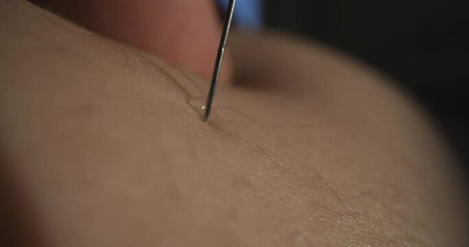 Close up of making a real injection in body. Doctor or nurse making an injection to a patient. Macro Shot