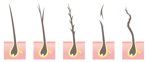 Types of hair problems cross section. Normal, split ends, damaged, break off, frizz. Vector illustration isolated on white background.
