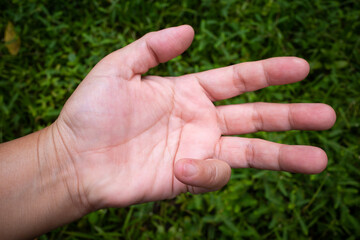 Trigger Finger lock on little finger of woman's front left hand, Suffering from pain, On green grass colour background,  Close up & Macro shot, Office syndrome, Health care concept