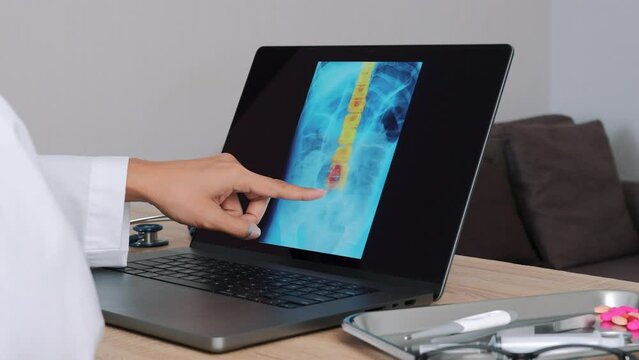 Woman Doctor showing x-ray with pain on the spine on a laptop. Slow motion from Left to Right