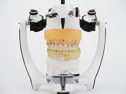dental articulator with metal ceramic bridge