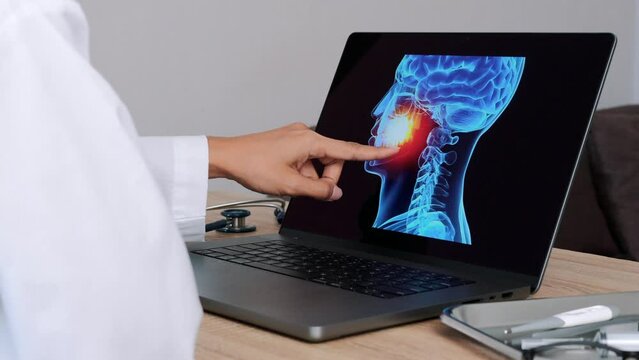 Dentist showing x-ray with pain in the mouth on a laptop. Slow Motion