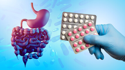 Treatment stomach. Tablets next to intestinal tract. Blisters with pills in mans hand....