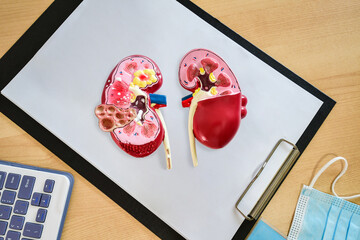 Kidney model. Organ donation concept in hospital and kidney anatomy for education.