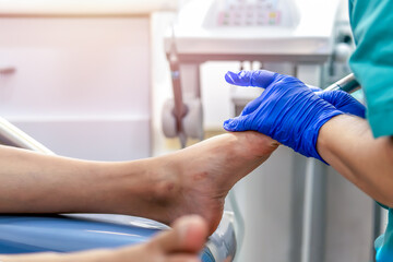 Obraz premium Close-up of a podiatry treatment. Selective focus