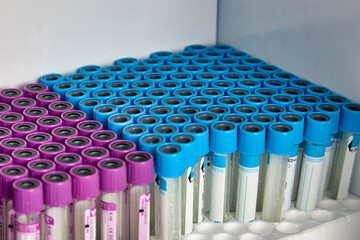 Set of empty vacuum tubes for taking venous blood in a clinical laboratory. Close-up of vacutainers prepared for blood tests from hospital patients