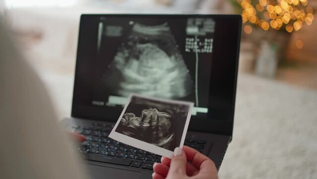 in female hands video and photo ultrasound of the unborn child