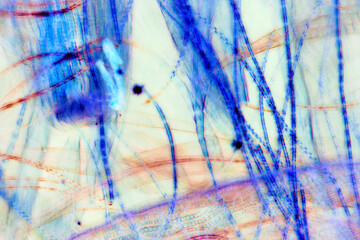 Abstract micrograph (maniuplated) of peat moss leaves, with polarization. - obrazy, fototapety, plakaty