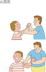 止血法