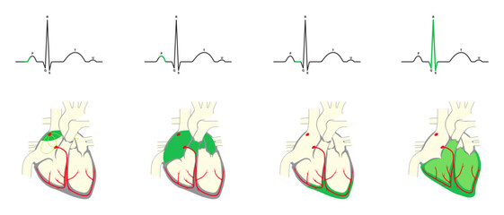 Normal heart rhythm. Electrocardiogram corresponding to the sequence of electrical events in the heart.
