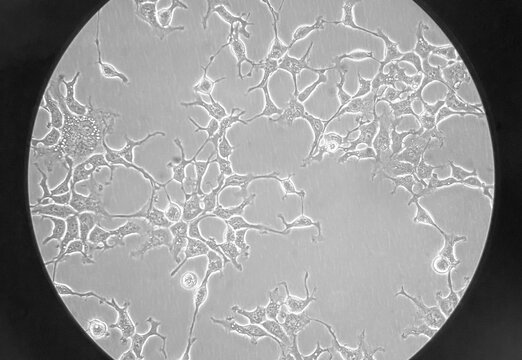 HEK-293 cells cultured in a DMEM medium. The cells are extensively exploited in receptor signaling, cancer research, and large-scale protein production.