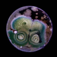 Samples of Petri dishes with a culture of microorganisms and fungi in the surface of agar nutrient...