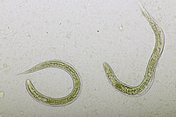 Strongyloides stercoralis or threadworm in human stool, analyze by microscope, original...