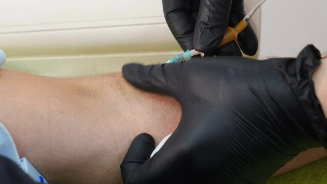 Aesthetic beauty clinic. Mesotherapy, ozone therapy. Carbon dioxide carboxy therapy. CO2 injections. Skin rejuvenation. Cosmetologist doctor using needle on device for gas injections of carboxytherapy