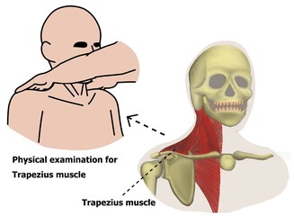 The physical examination of cranial nerve 11th via trapezius and sternocleidomastoid muscles power testing. - obrazy, fototapety, plakaty