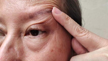 Naklejka premium Portrait showing the finger pointing the Wrinkles and flabby skin beside the eyelid, cellulite and dark spots on the face, problem blemish and Dullness of the woman, concept health care.