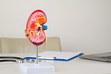 mockup kidney on work desk of doctor
