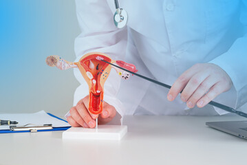 doctor gynecologist pointing model of female reproductive system on his desktop