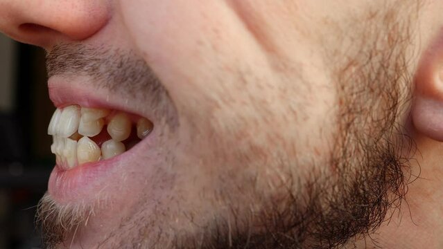 The man shows his crooked and protruding teeth. Malocclusion. Close-up.