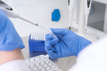 Doctor holding blood tube test in the research laboratory.Corona virus pandemic concept.Coronavirus vaccine development